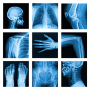 icon Medical X-Ray Interpretation with 100+ Cases