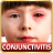 icon Help & Home Remedies For Pinkeye conjunctivitis in Kids 1.4